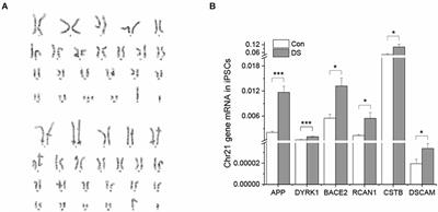 Alzheimer’s disease like neuropathology in Down syndrome cortical organoids